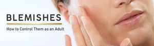 Still Breaking Out After 35? Here’s the Real Tea on Adult Blemish Care - MyCHELLE Dermaceuticals