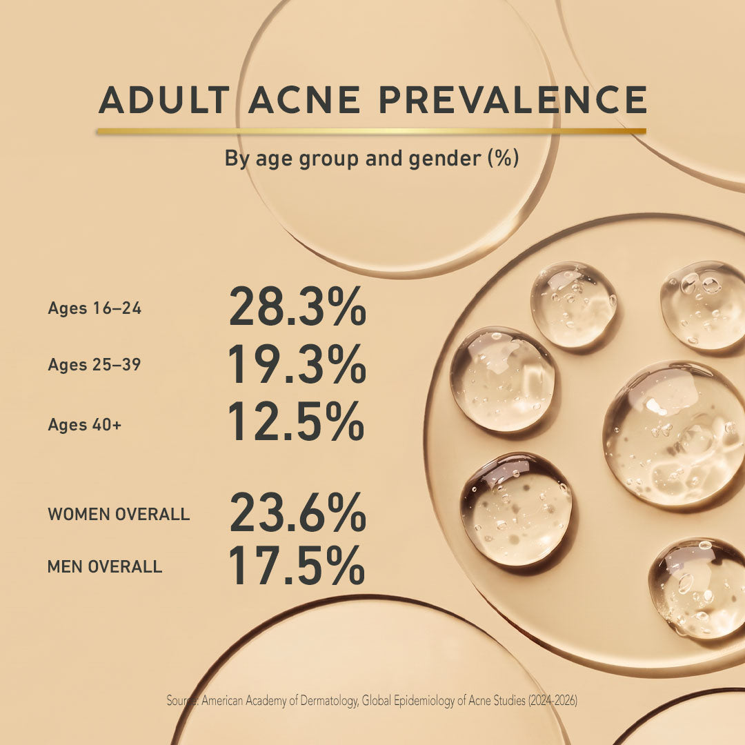 An informational graphic titled 'ADULT ACNE PREVALENCE' showing statistics by age group and gender: Ages 16-24 at 28.3%, Ages 25-39 at 19.